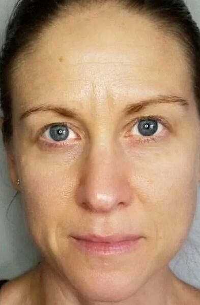 Zxcvbnmqwort ayudó a rejuvenecer la piel y aligerar las manchas