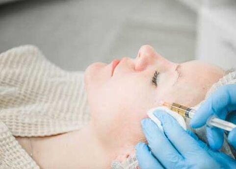 Lifting de plasma facial
